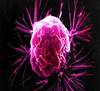 A breast cancer cell