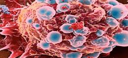 Cancer cells, Photo: healerslibrary.com