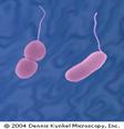 Vibrio parahemolyticus C