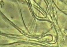 Image result for green non sulfur bacteria